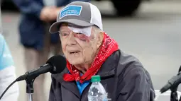 Mantan Presiden AS, Jimmy Carter menghadiri acara yang digelar Habitat for Humanity di Nashville, Tennessee, Senin (7/10/2019). Tampil di depan publik, mata kiri Carter memar dan mendapat beberapa jahitan di alis bagian atas setelah terjatuh di rumahnya pada Minggu waktu setempat. (AP/Mark Humphrey)
