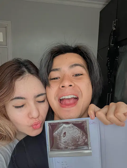 Arnold Leonard dan Moniq Crasivaya umumkan kabar kehamilan (Foto: Instagram arnoldleonard05)