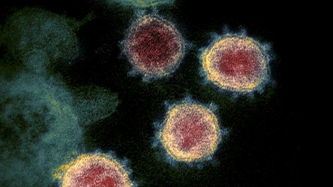 Gambar ilustrasi ini dengan izin dari National Institutes of Health pada 27 Februari 2020. Menunjukkan mikroskopis elektron transmisi SARS-CoV-2 juga dikenal sebagai 2019-nCoV, virus yang menyebabkan Corona COVID-19. (AFP/National Institutes of Health).