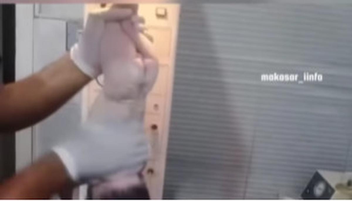 Bayi Baru Lahir Ditampar Berkali-kali oleh Dokter Malah Dipuji Netizen, Ternyata ini yang Terjadi