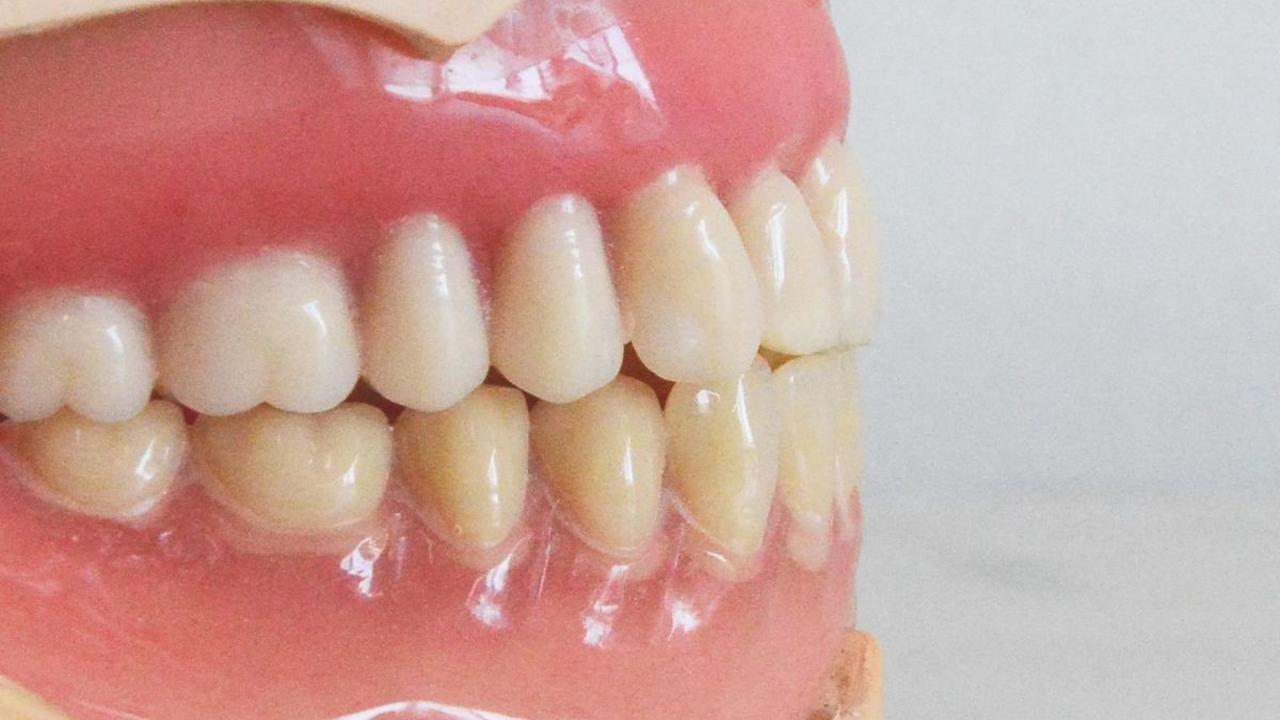 <b>Apa Itu Bleaching Gigi?</b>