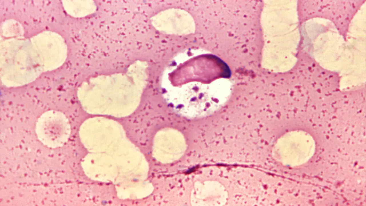 Leishmania