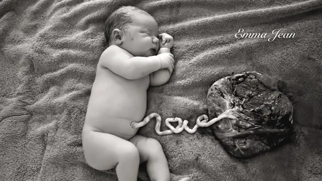 Bidan Ini Abadikan Plasenta Bayi Lewat Foto Menyentuh Hati