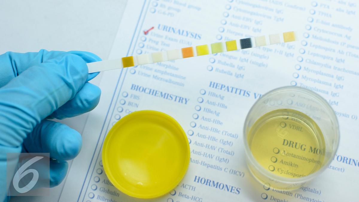 Ciri-ciri Penyakit Darah Tinggi pada Urine, Perlu Diwaspadai