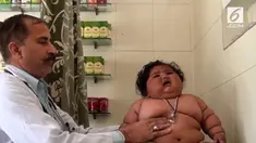 Seorang bayi Perempuan asal India alami obesitas parah. Bobotnya mencapai 17 kg saat ia masih berusia 8 bulan.
