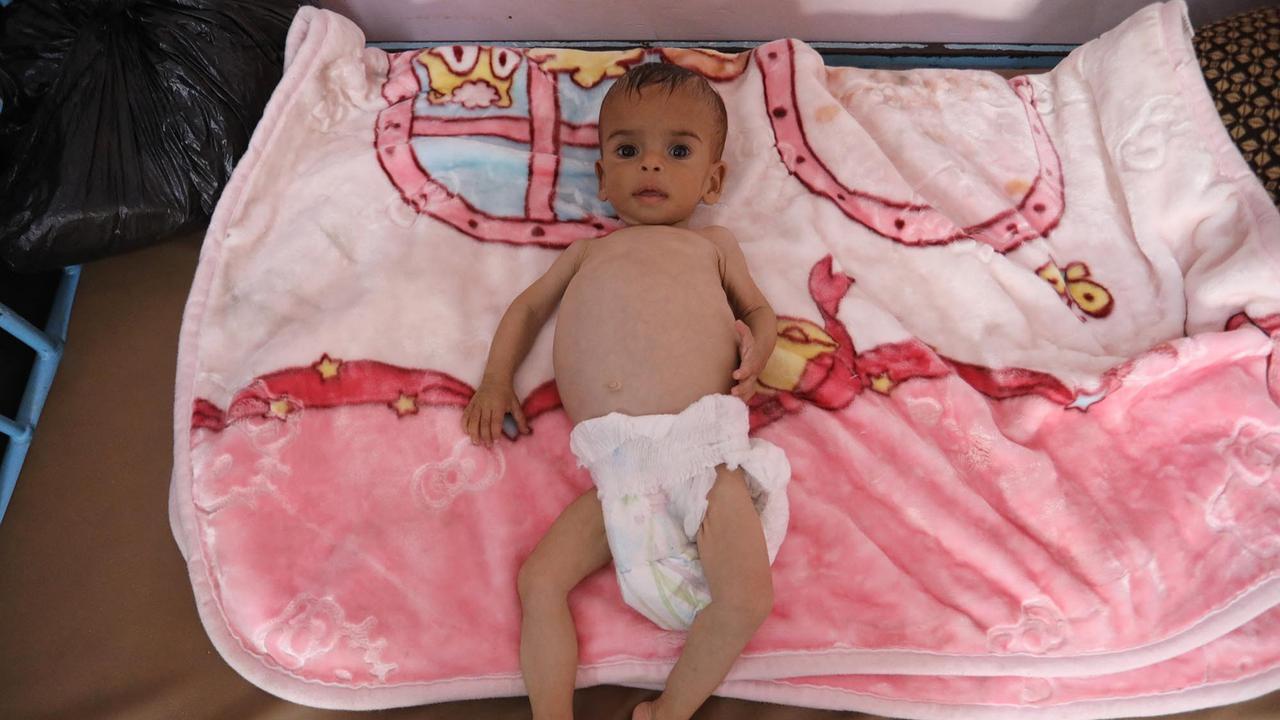 FOTO: Tubuh Kecil yang Lapar, Potret Pedih Bayi Gaza di Tengah Ancaman Kelaparan Massal