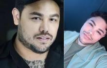 10 Potret Artis Sebelum-Sesudah Filler Bibir, dari Ivan Gunawan sampai Momo Eks Geisha