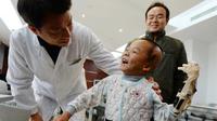 Tim spesialis di sebuah rumah sakit di Wuhan, China, mampu memberikan bocah laki-laki berusia lima tahun mendapatkan tangannya kembali.