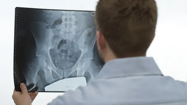 Hernia adalah