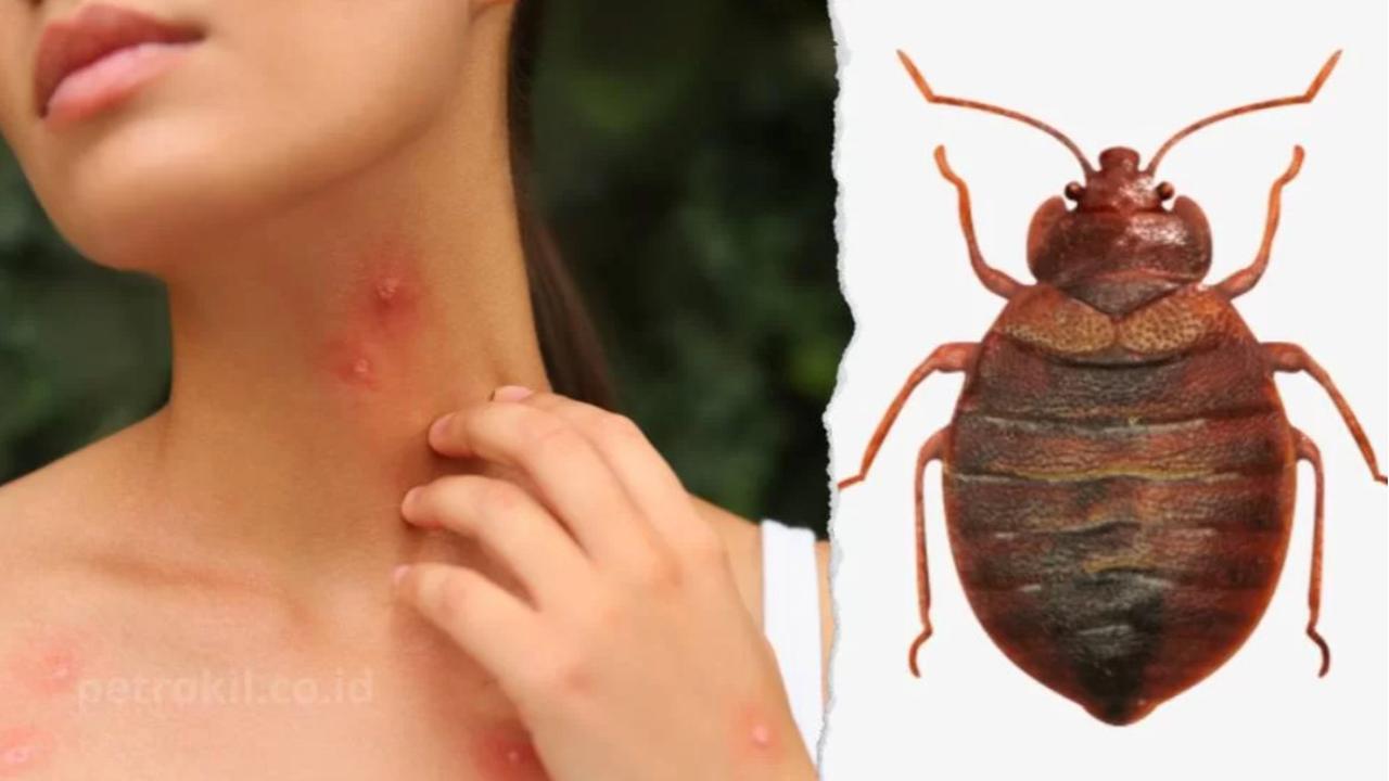 Rahasia Ampuh Menghilangkan Kutu Kasur, Rumah Bebas Gatal dalam Waktu Singkat!