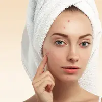 ilustrasi rekomendasi obat jerawat dari korea/pexels