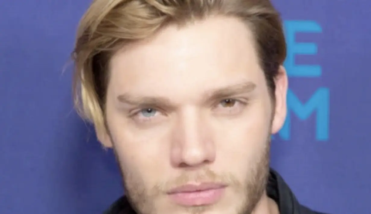 Dominic Sherwood memiliki kondisi heterokromia pada salah satu matanya. Mata kirinya sebagian berwarna biru, sementara sebagian lagi berwarna cokelat. [Foto: Dominic Sherwood]