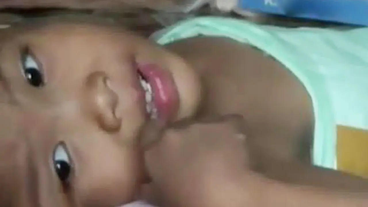Bocah Kutai Timur dengan Usus di Luar Butuh Bantuan