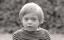 21 Maret Hari Down Syndrome Sedunia, Ketahui Sejarahnya