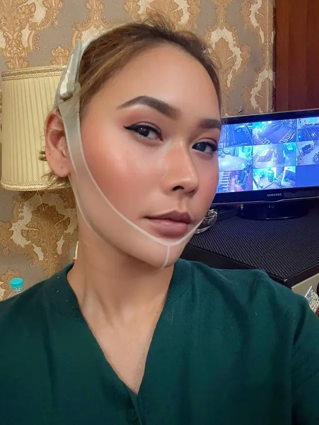 6 Potret Inul Daratista Perawatan Wajah Tirus Tanpa Oplas, Rutin Pakai Korset