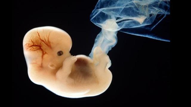 Kontroversi, Ilmuwan Edit Gen Embrio Manusia Untuk Cegah Penyakit