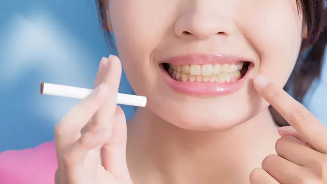 Kiat Menjaga Gigi Tetap Putih Bagi Perokok