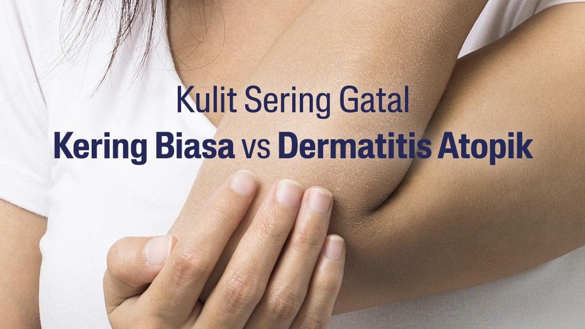 Tips Memilih Pelembab yang Tepat untuk Kulit Eksim, Jaga Skin Barrier