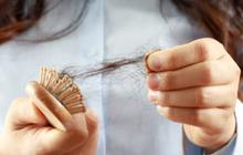 Rambut Rontok? Kenali Penyebab dan Temukan Solusi yang Tepat