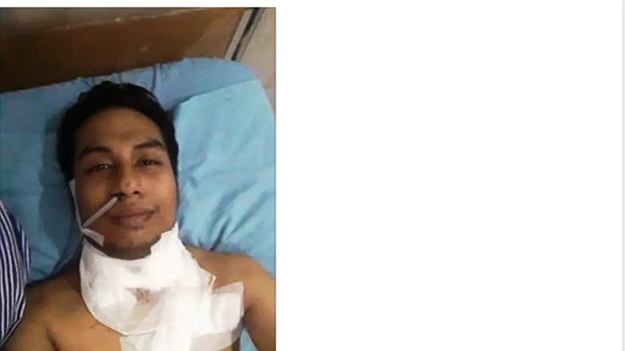 Terkena Kanker Pita Suara, Ini yang Terjadi Pada Robby