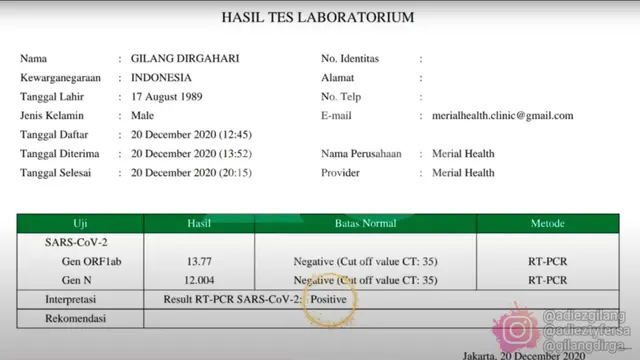 Posistif Covid-19, Gilang Dirga Jalani Isolasi Mandiri di Kantor
