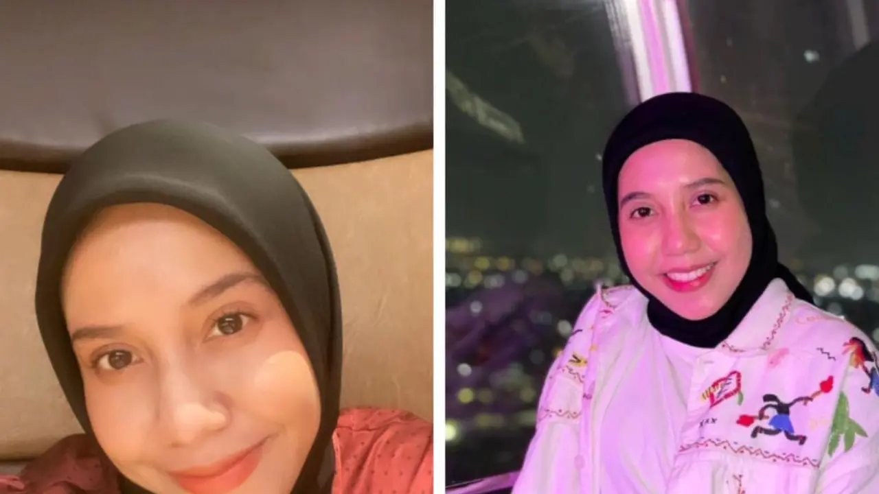 Potret Terbaru Nadya Arifta, Pamer Senyum Jelang Pernikahan Kaesang dan Erina