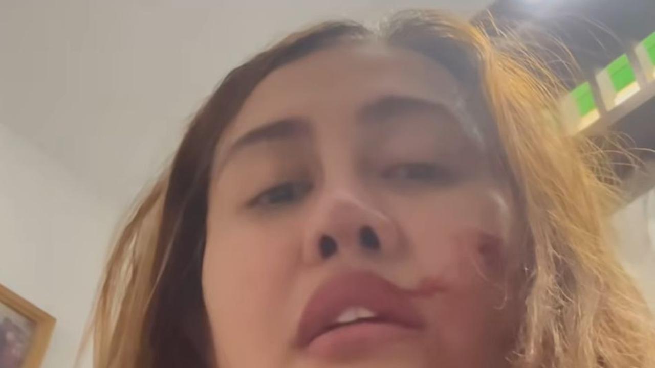 Pedangdut Ratu Meta Unggah Video Cekcok dengan Suami, Ungkap Kekerasan yang Diduga KDRT