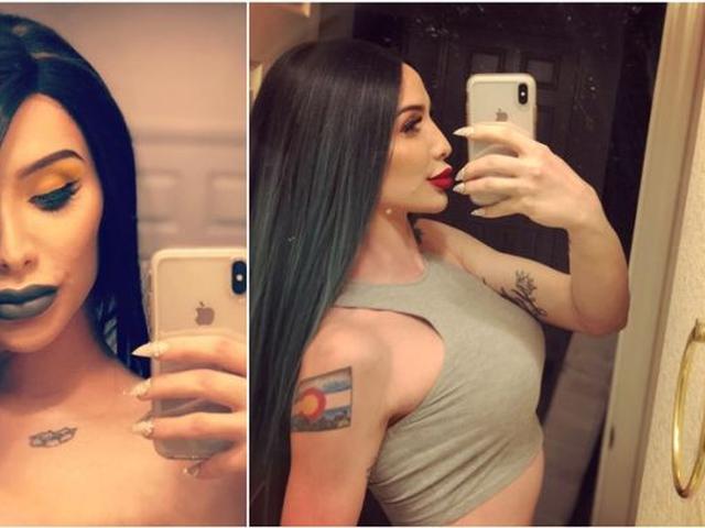 Transgender Ini Habiskan Rp 1 M Demi Mirip Kylie Jenner Hasilnya