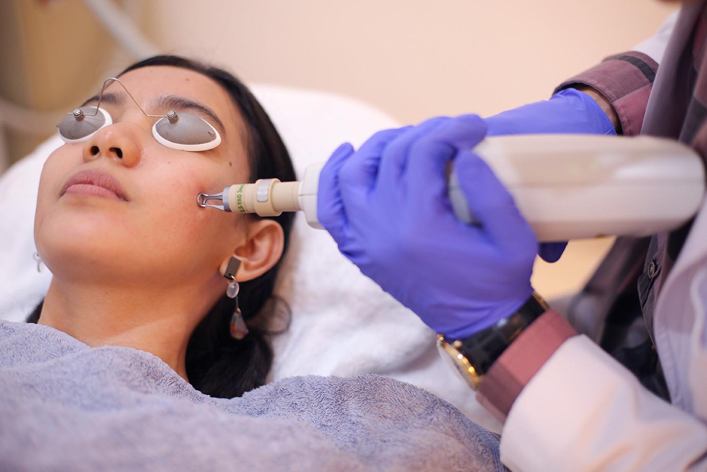 Laser Resurfacing Untuk Lubang Bekas Jerawat We Tried Laser Rejuvenation Tingkatkan Kolagen dan Bekas 