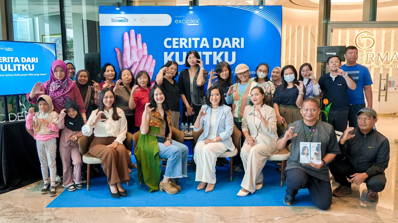 Dukung Penyintas, Komunitas Vitiligo Indonesia dan C Derma Gelar Kampanye Cerita dari Kulitku