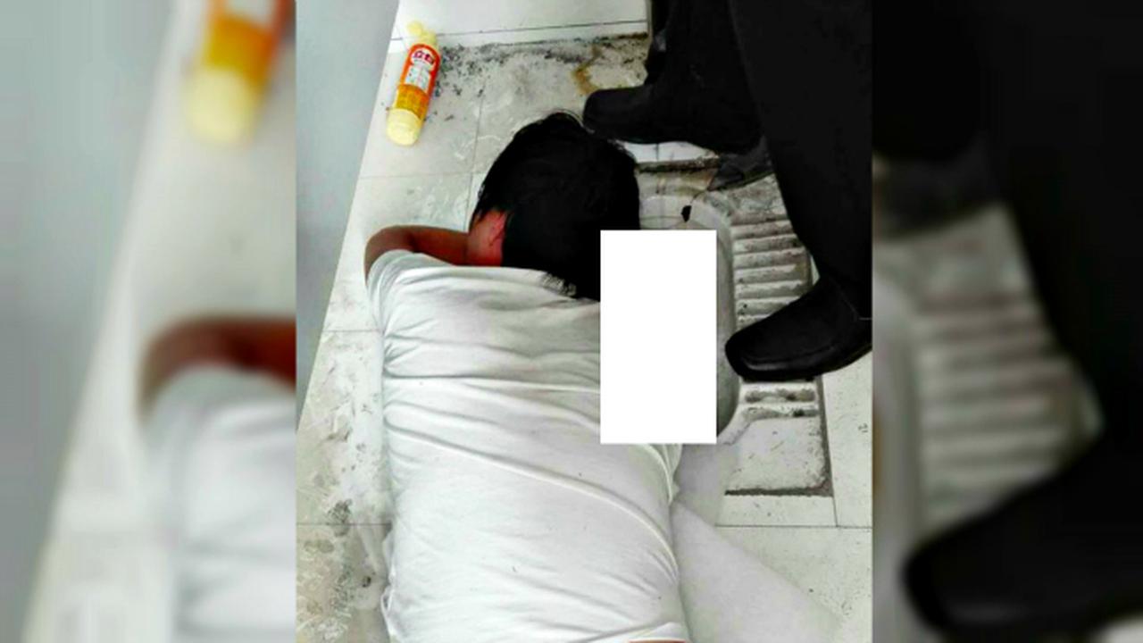 Ogah Rugi, Tangan Pemuda Ini Malah Tersangkut Dalam Jamban