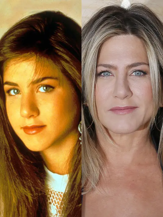 Aktris papan atas seperti Jennifer Aniston pun tak lepas dari operasi hidung loh! (REX/Shutterstock/HollywoodLife)