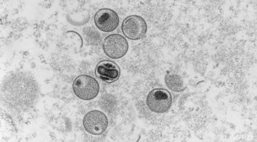 Tangkapan mikroskop elektron bagian ultratipis dari virus cacar monyet file 2004. (Gambar: AFP/RKI Institut Robert Koch/Freya Kaulbars)