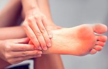 Penyebab Plantar Fasciitis, Gejala, dan Cara Mengatasinya