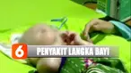 Kulit Mizyan sempat mengelupas, namun setelah dirawat kondisinya berangsur membaik.