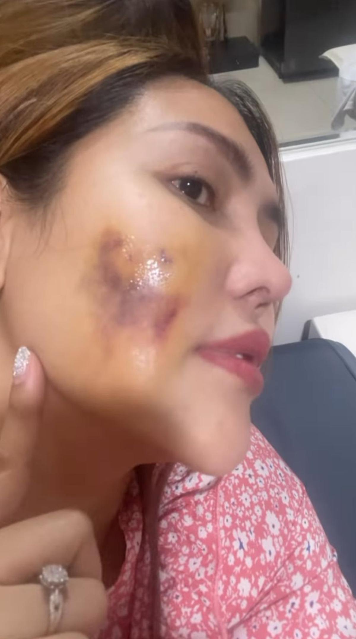 Pedangdut Ratu Meta Unggah Video Cekcok dengan Suami, Ungkap Kekerasan yang Diduga KDRT