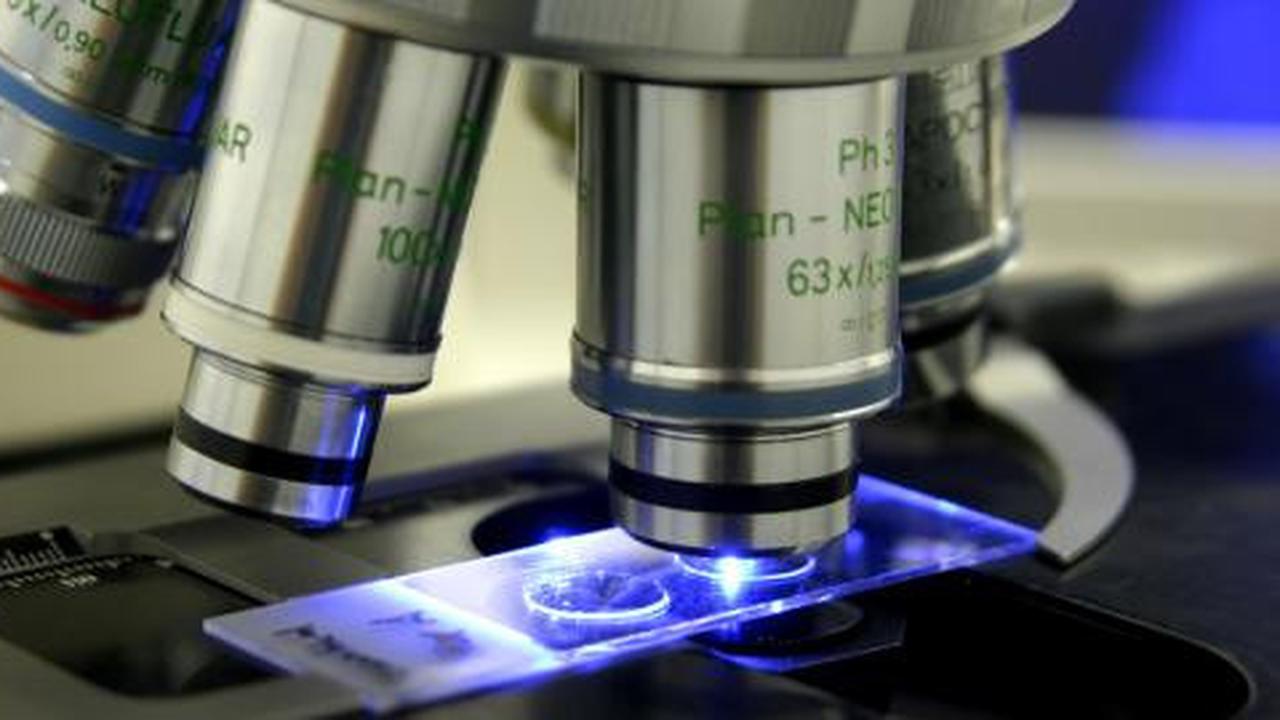 Peneliti kembangkan metode nanopartikel untuk sembuhkan kanker