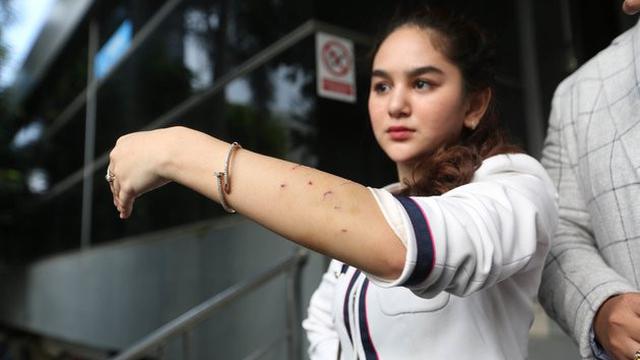 Potret Hana Hanifah saat melapor ke Polda Metro Jaya