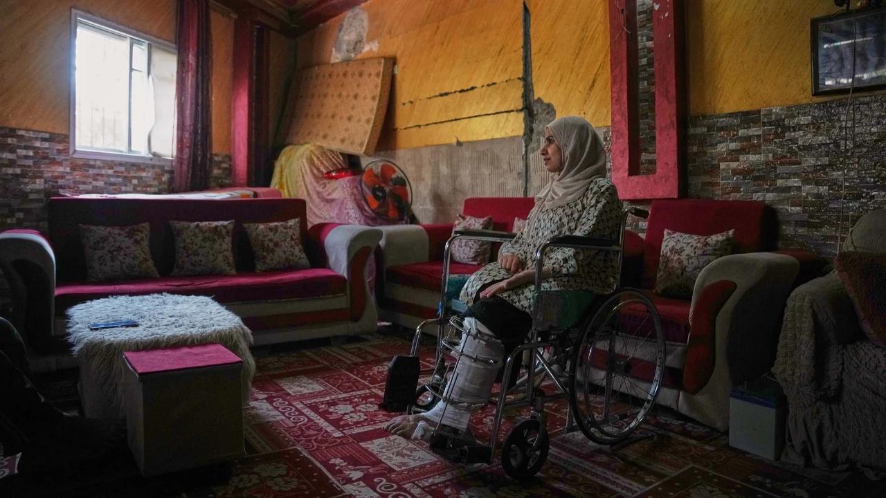 FOTO: Menanti Kaki Palsu di Tengah Luka Perang Gaza
