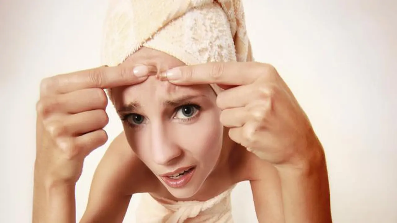 Ingin Jerawat Cepat Hilang? Minum Teh Herbal Ini
