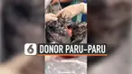 Chen Jingyu, ahli bedah tranplantasi paru-paru dari Rumah Sakit Rakyat Wuxi di Jiangsu, China segera menolak paru-paru yang didonorkan setelah melihat kondisinya. Paru-paru tersebut menghitam, karena berasal dari seorang perokok berat.