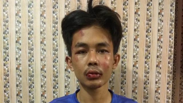 pelaku penusukan syekh Ali jaber