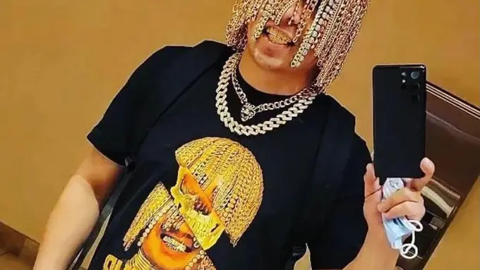 Viral Aksi Ekstrem Rapper Meksiko Nekat Tanam Rantai Emas di Kepala