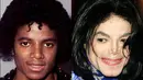 Kita semua pasti mencintai the King of Pop ini. Namun kamu pasti setuju bahwa keputusan Michael Jackson mengubah wajahnya terus-menerus bukanlah ide yang baik. (FoxNews)