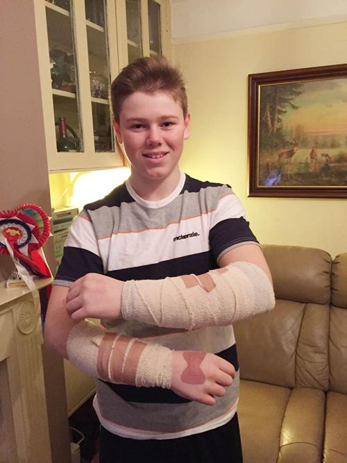 Remaja ajaib Jack Fox yang hanya alami luka ringan meski jatuh dari atas tebing tinggi | Photo: Caopyright mirror.co.uk