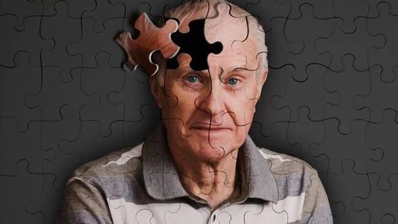 Alzheimer