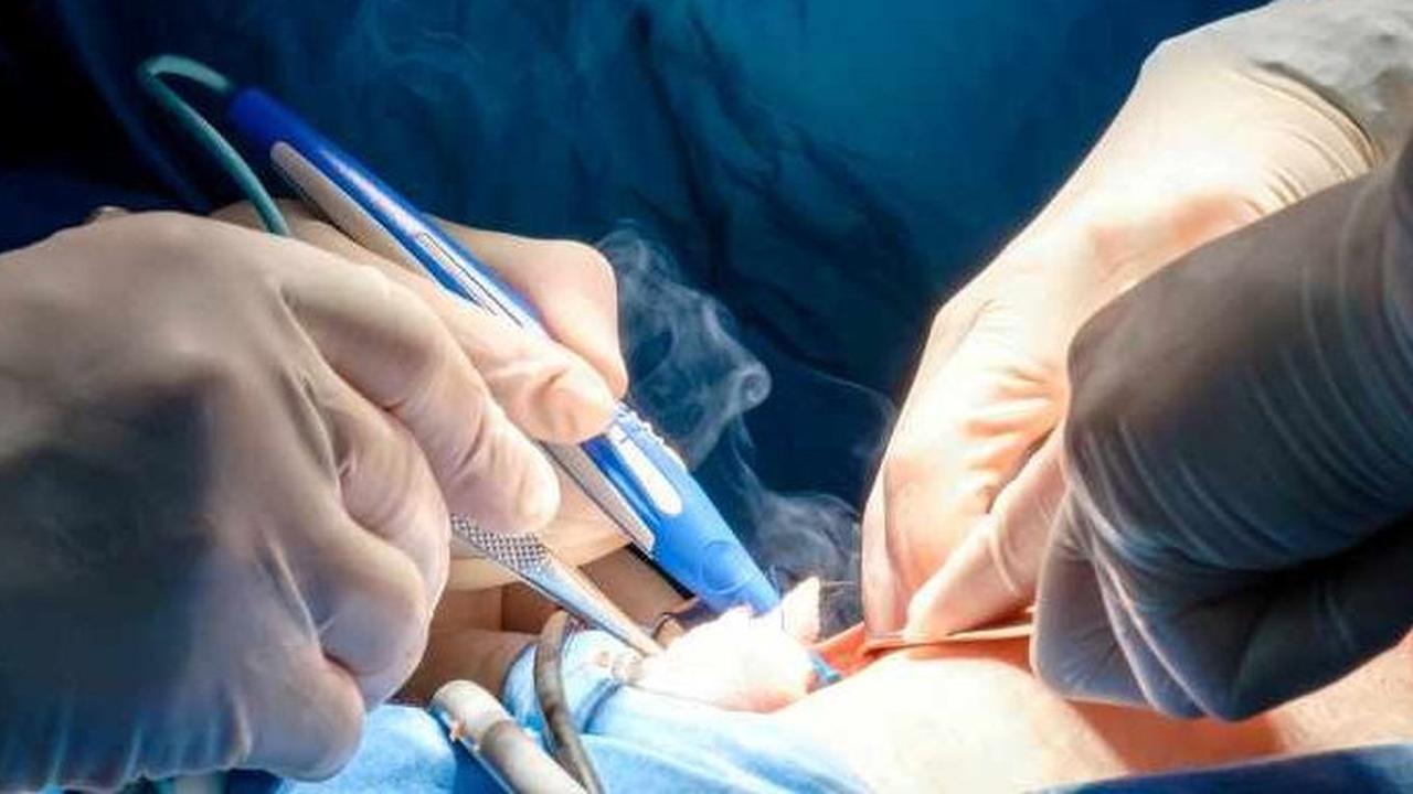 Apa Itu Parafimosis? Komplikasi dan Cara Mengatasi, Sunat Bisa Jadi Solusi?