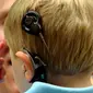 Orangtua harus memerhatikan sebelum anak dipasang implan koklea. (Ilustrasi: Utah People Post)