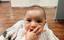 9 Potret Perjuangan Acha Sinaga Rawat Baby Kenan yang Didiagnosis Idap Hip Dysplasia di Usia 3 Bulan