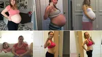 Tak Langsung Kurus Usai Melahirkan, Wanita Ini Bagi Kisahnya